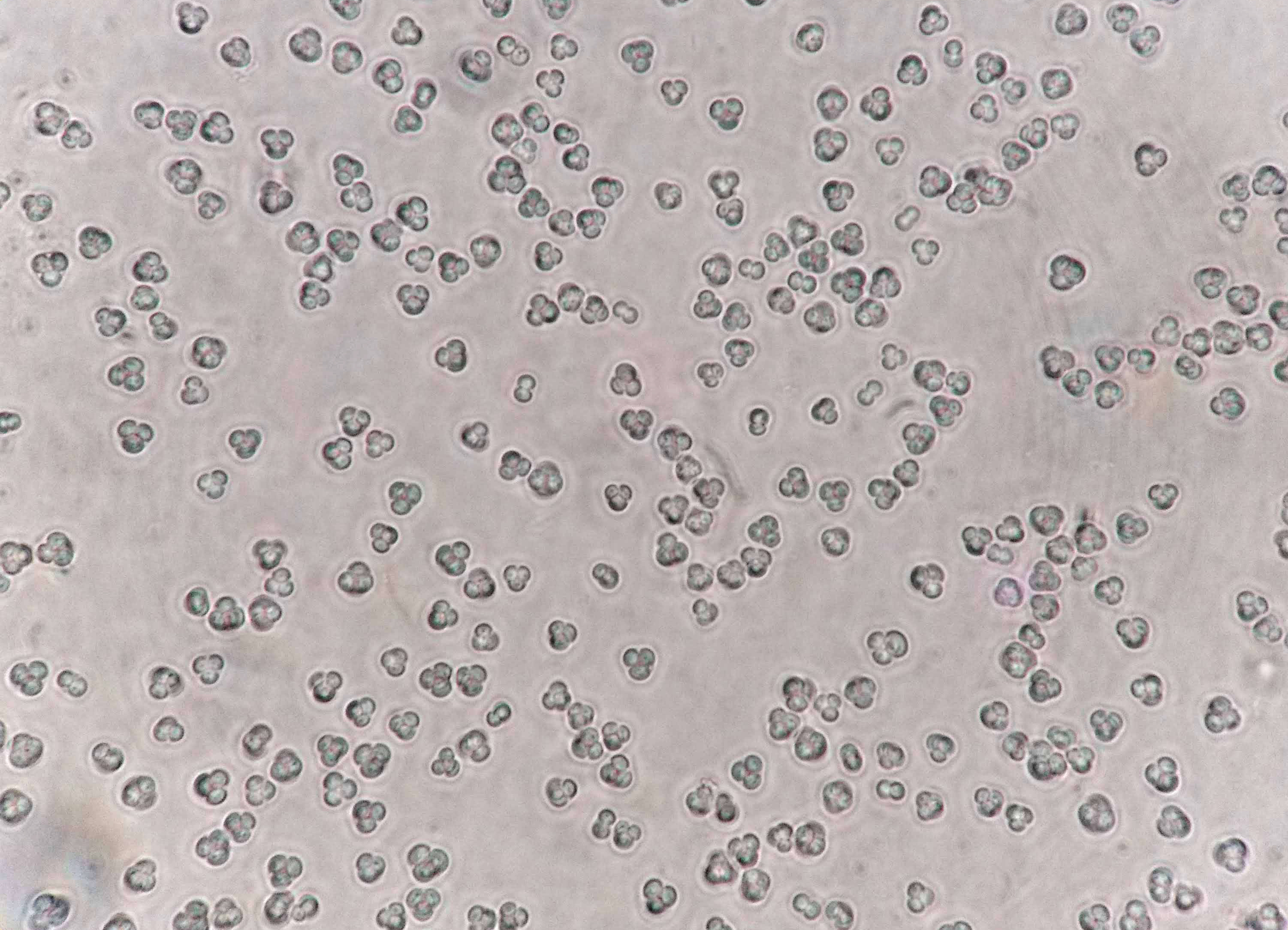 Recreating a key event of Saccharomyces yeasts evolution in the lab!