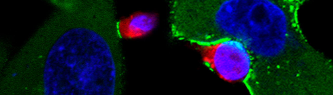 HIV entry into the wrong T cell: not a “dead-end” but a “highway” for viral spread