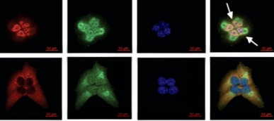 Serum deprivation initiates adaptation and survival to oxidative stress in prostate cancer cells
