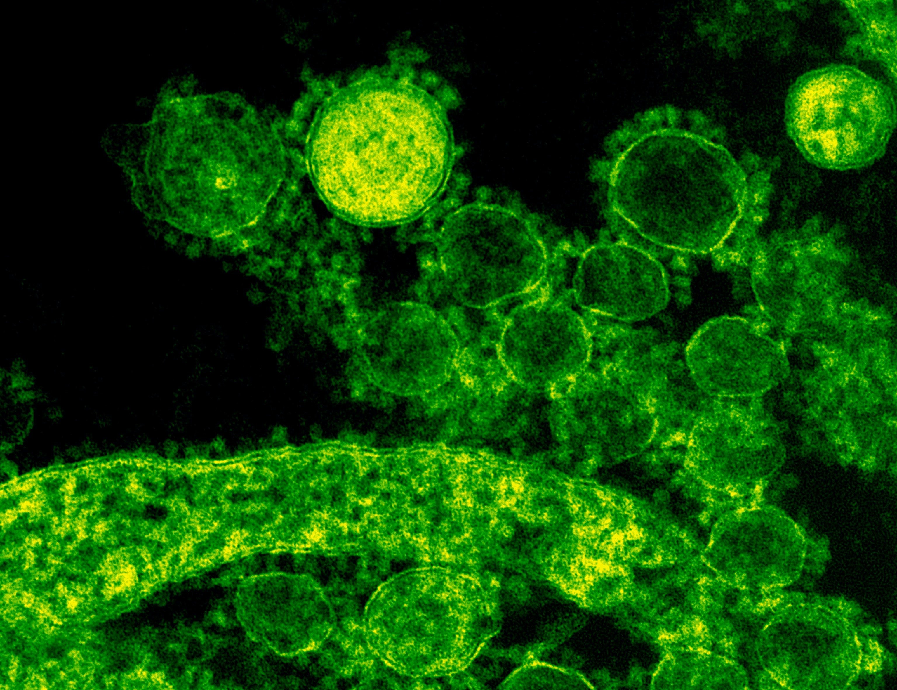 Quantum microscope turns down the heat: nonlinear microscopy beyond photodamage limits