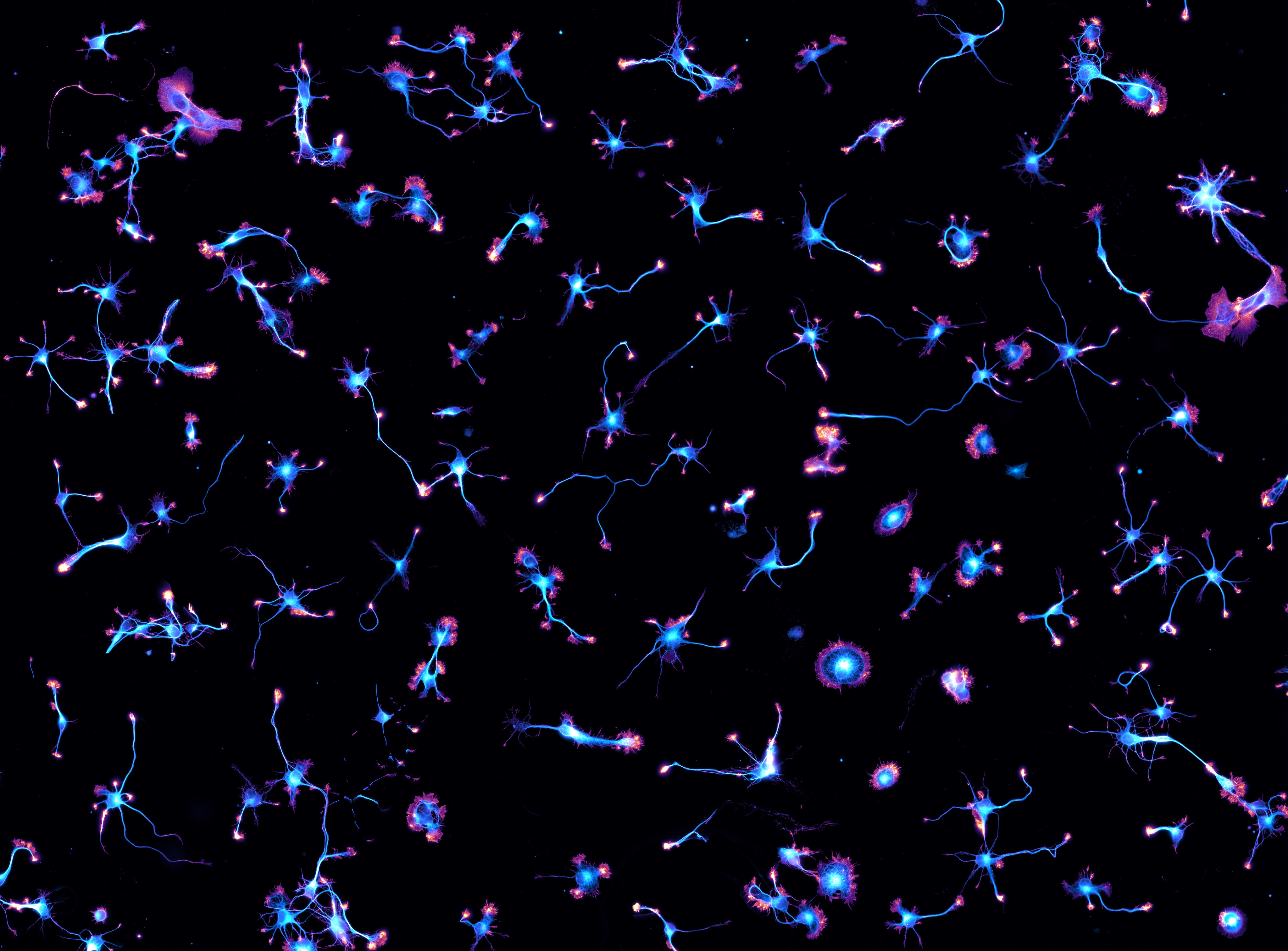 Cytoskeleton moves
