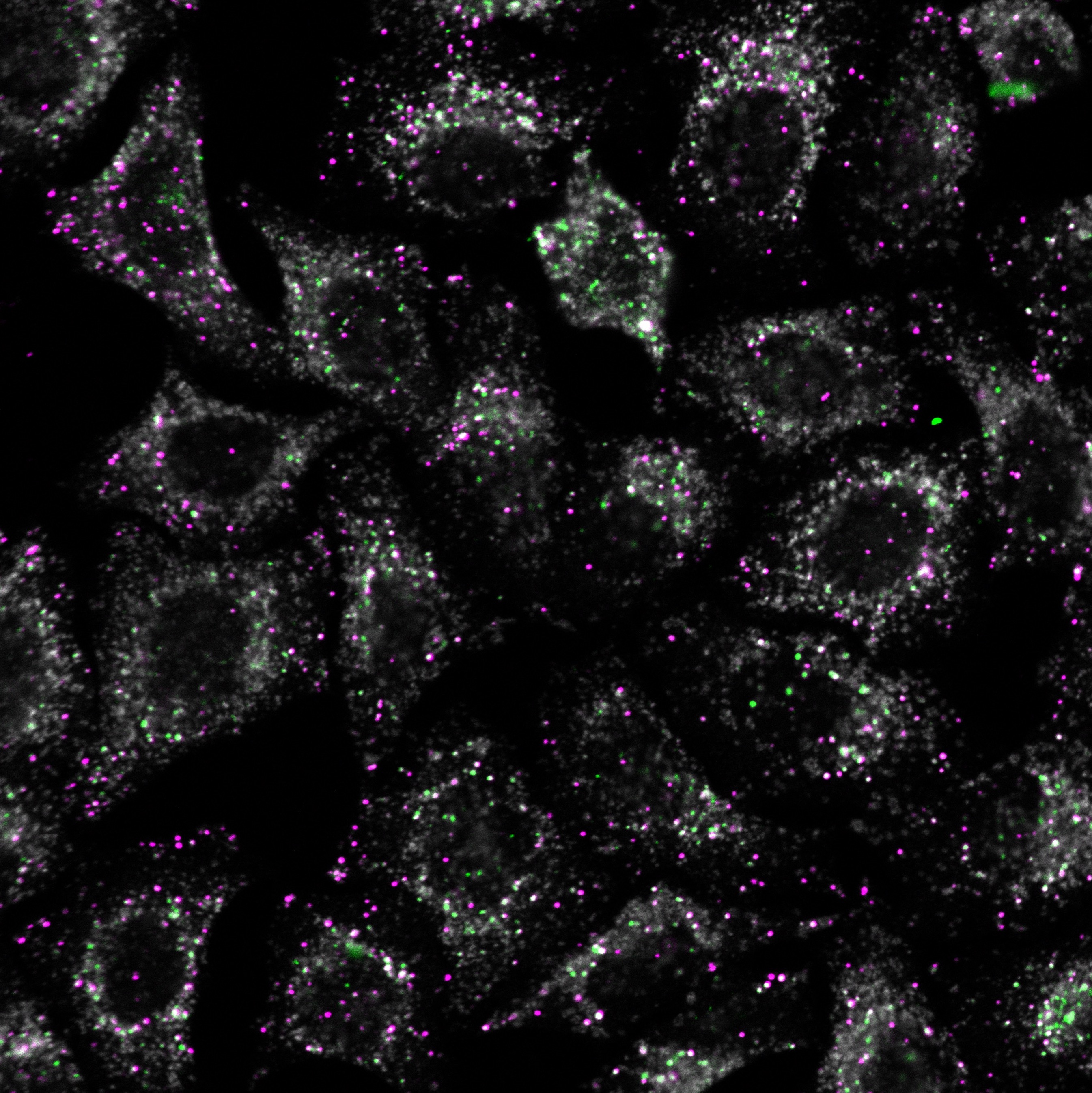 The Tethering Complex Revisited: Discovery of New Complexes Regulating Vesicle Fusion in Endocytic Pathways