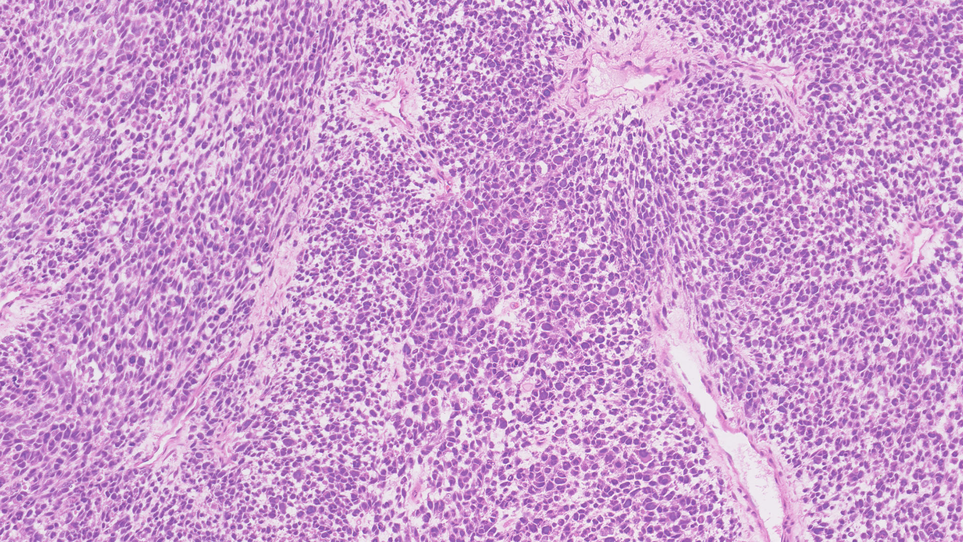 Double Trouble: Whole Genome Duplication & Immune Disruption in Testicular Cancers