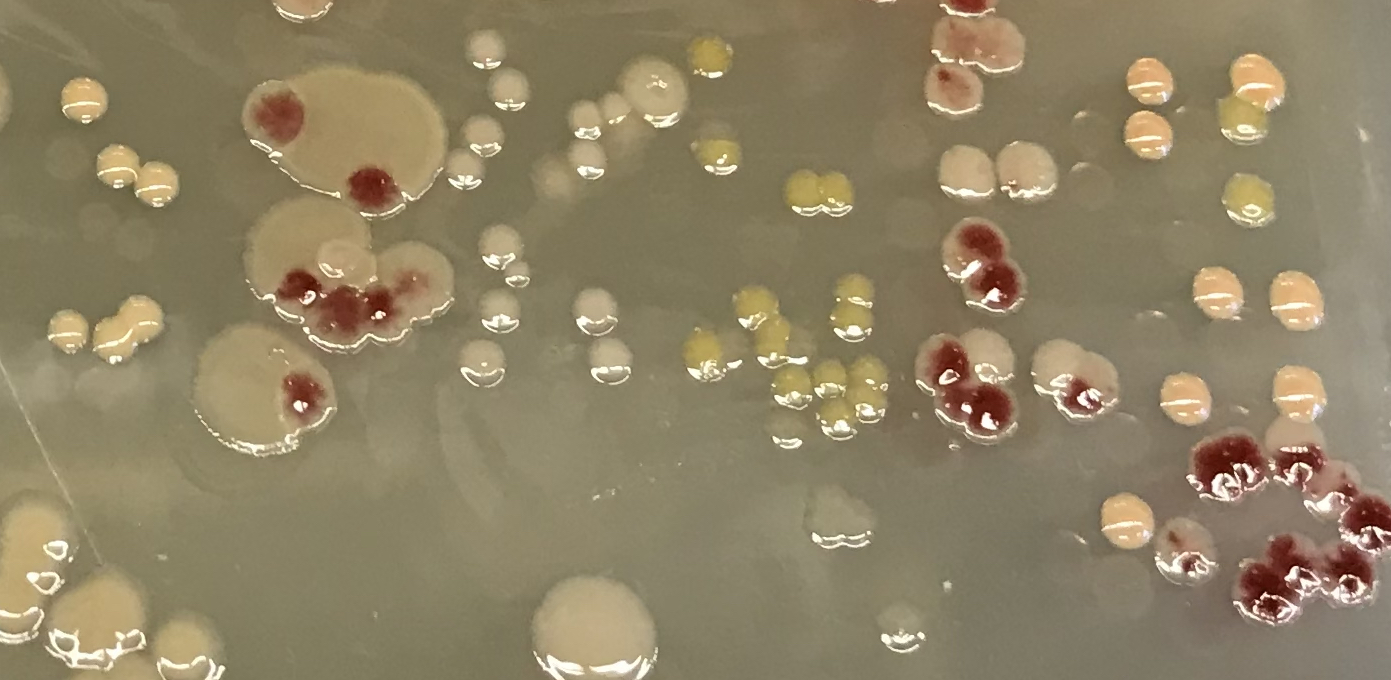 Microbial experiments reveal surprising tradeoff