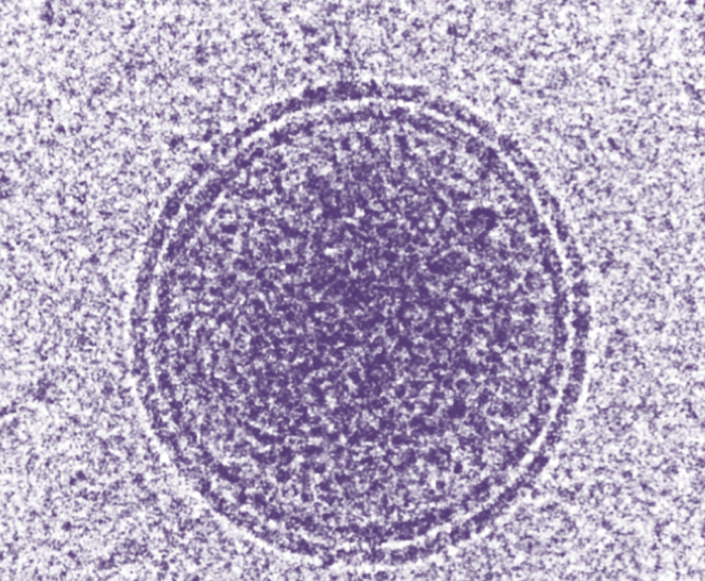 Vesiclemia