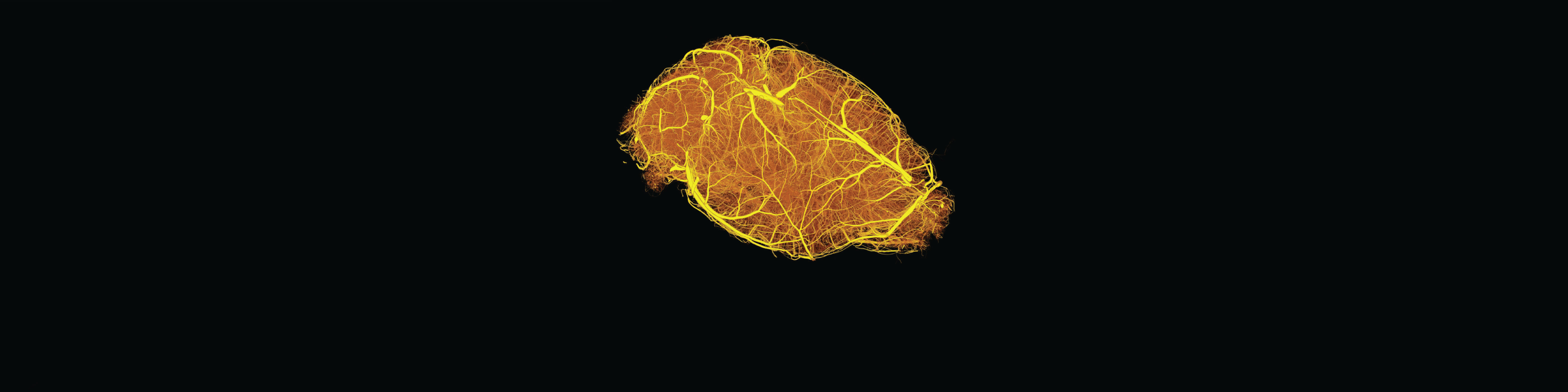 Hierarchical imaging and computational analysis of three-dimensional vascular network architecture in the entire postnatal and adult mouse brain