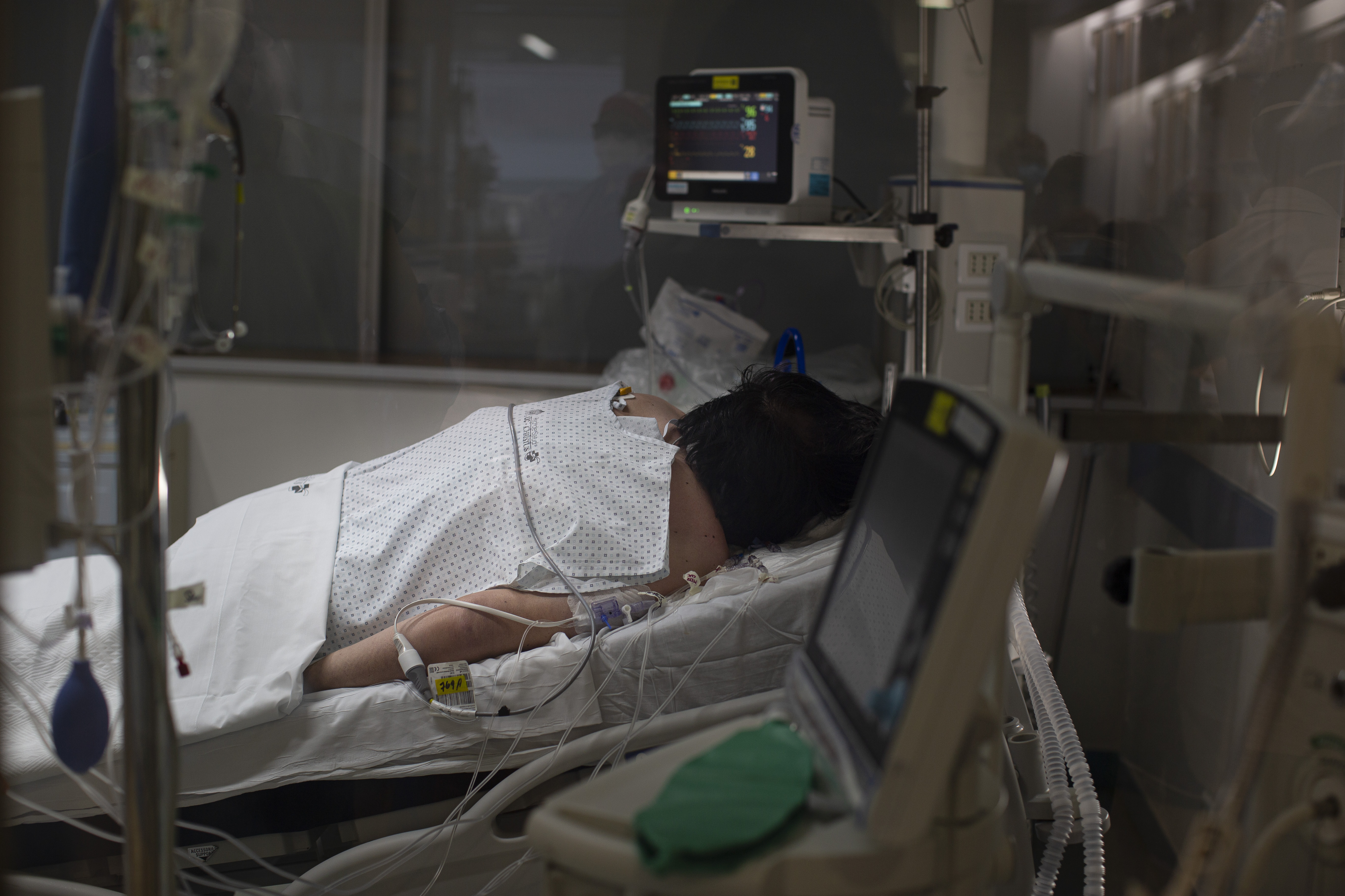The unexpected role of severe COVID-19 in the Tuberculosis resurgence