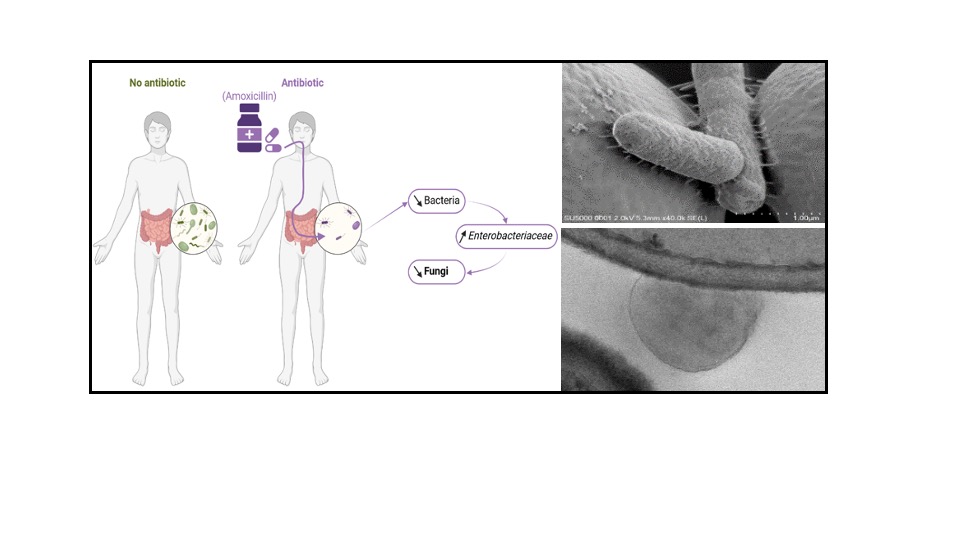 Antibiotic treatment also affects the intestinal fungal microbiota