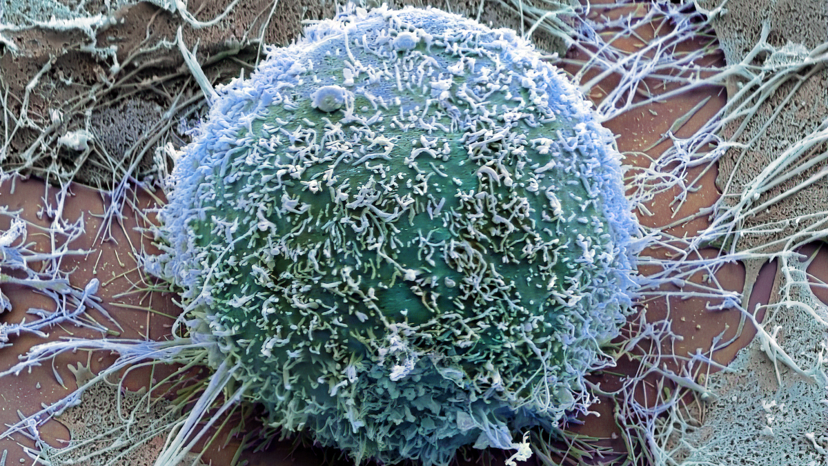 Call for papers: Alternative cell death mechanisms in cancer