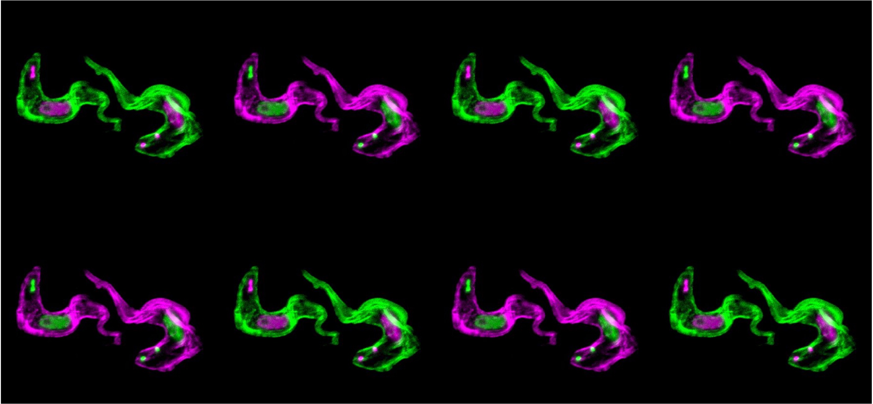 A Molecular Shredder at the Source: How Trypanosomes Fine-Tune Their Surface Coat