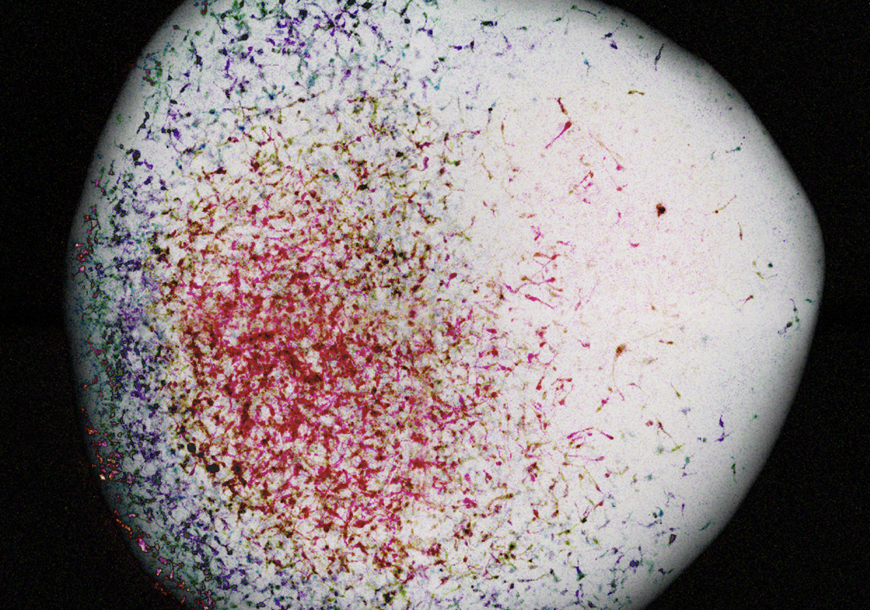 From development to tumorigenesis:  novel human brain organoids 