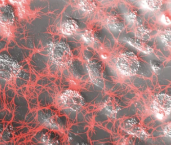 SARS-CoV-2 infection of human lung epithelial cells induces TMPRSS-mediated acute fibrin deposition
