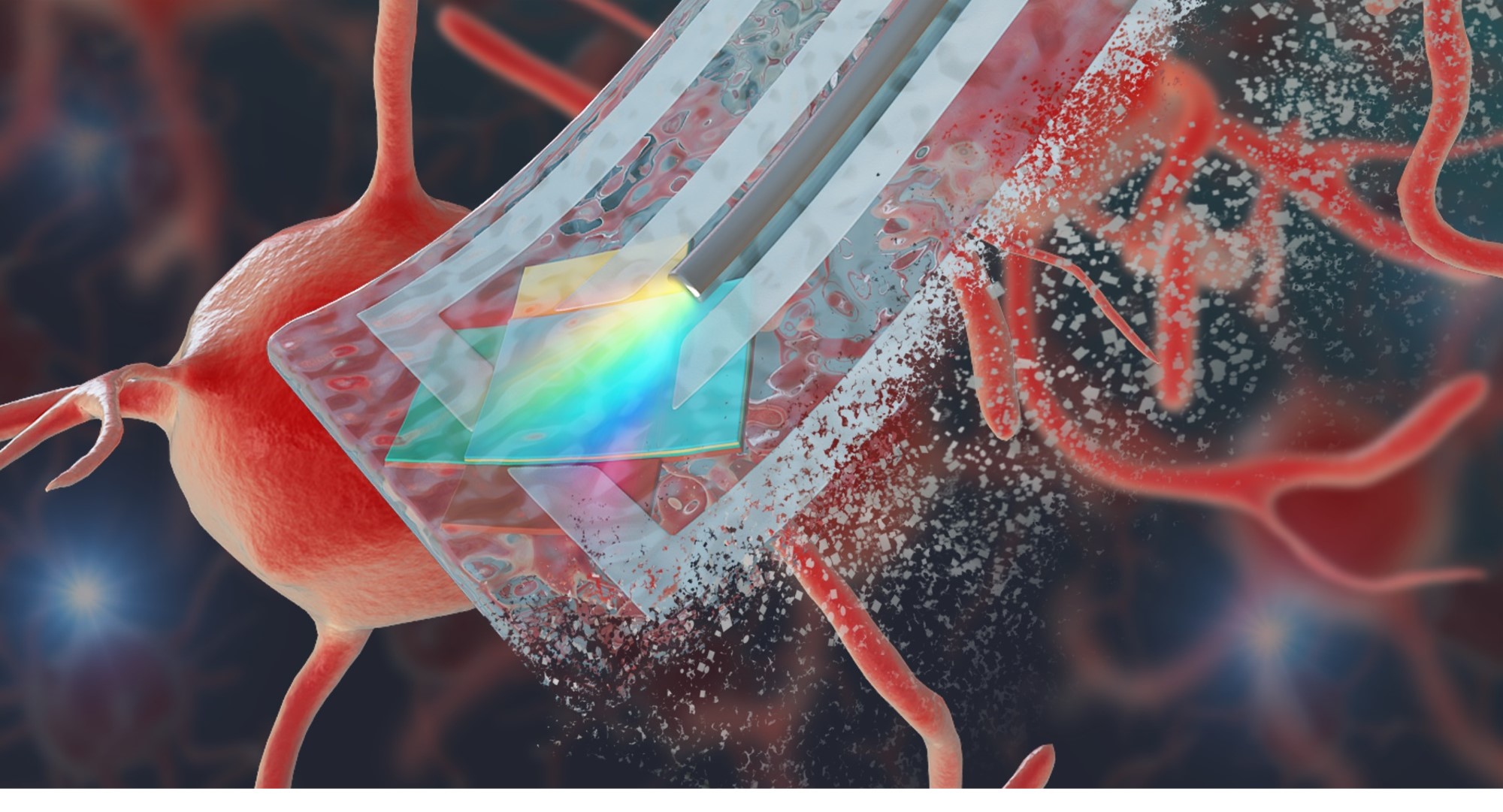 Transient implants that use optical spectroscopy to diagnose local tissue