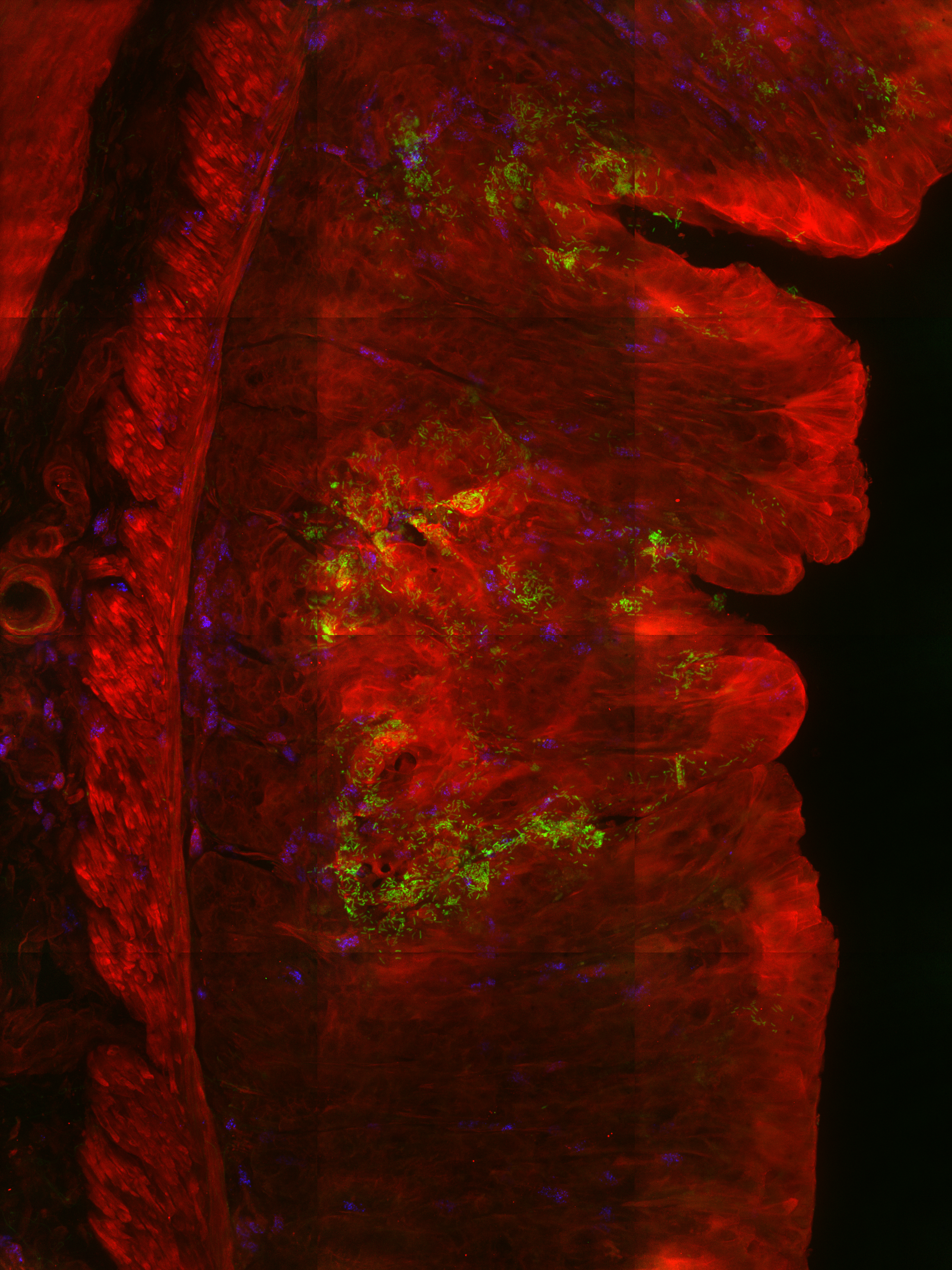 “By the way, it’s Shigella that consumes the most oxygen, not neutrophils. Is that normal?”
