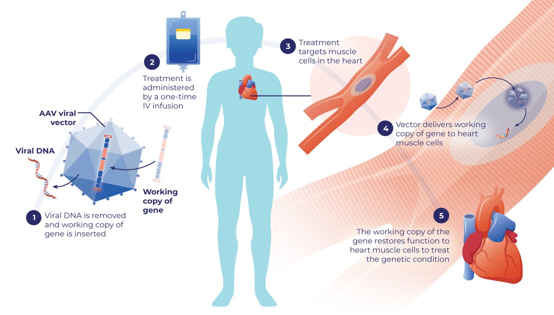 Designing a PKP2 Gene Therapy to Target Cardiomyocytes for Treatment of Arrhythmogenic Right Ventricular Cardiomyopathy
