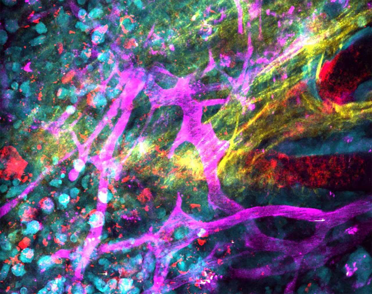 Imaging non-healing wounds