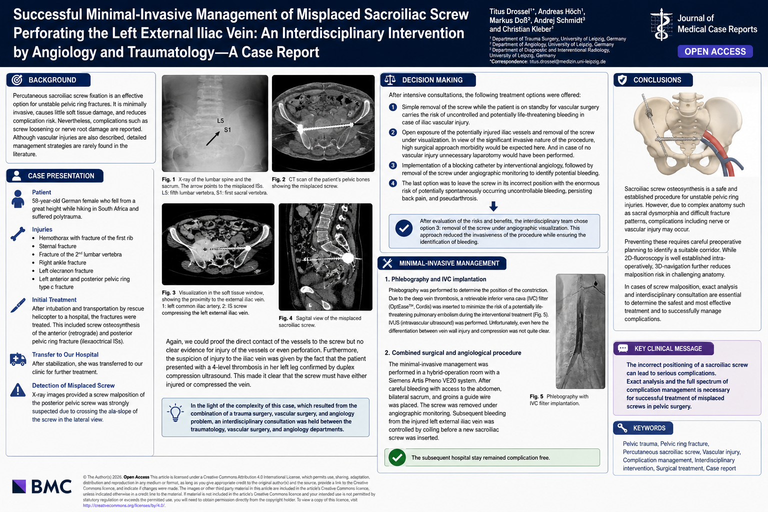 When a Sacroiliac Screw Becomes a Vascular Emergency: An Interdisciplinary, Minimally Invasive Solution to External Iliac Vein Perforation