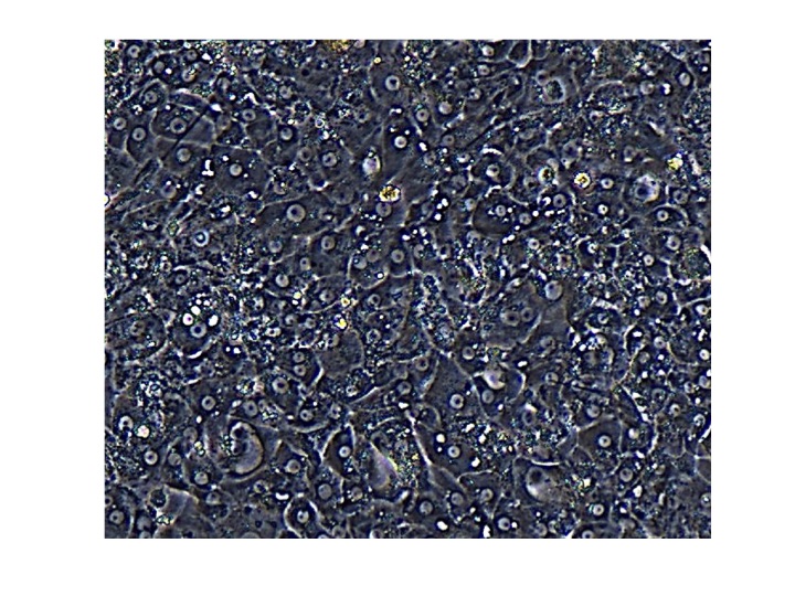 Modeling chronic hepatitis B virus infection in cell culture.