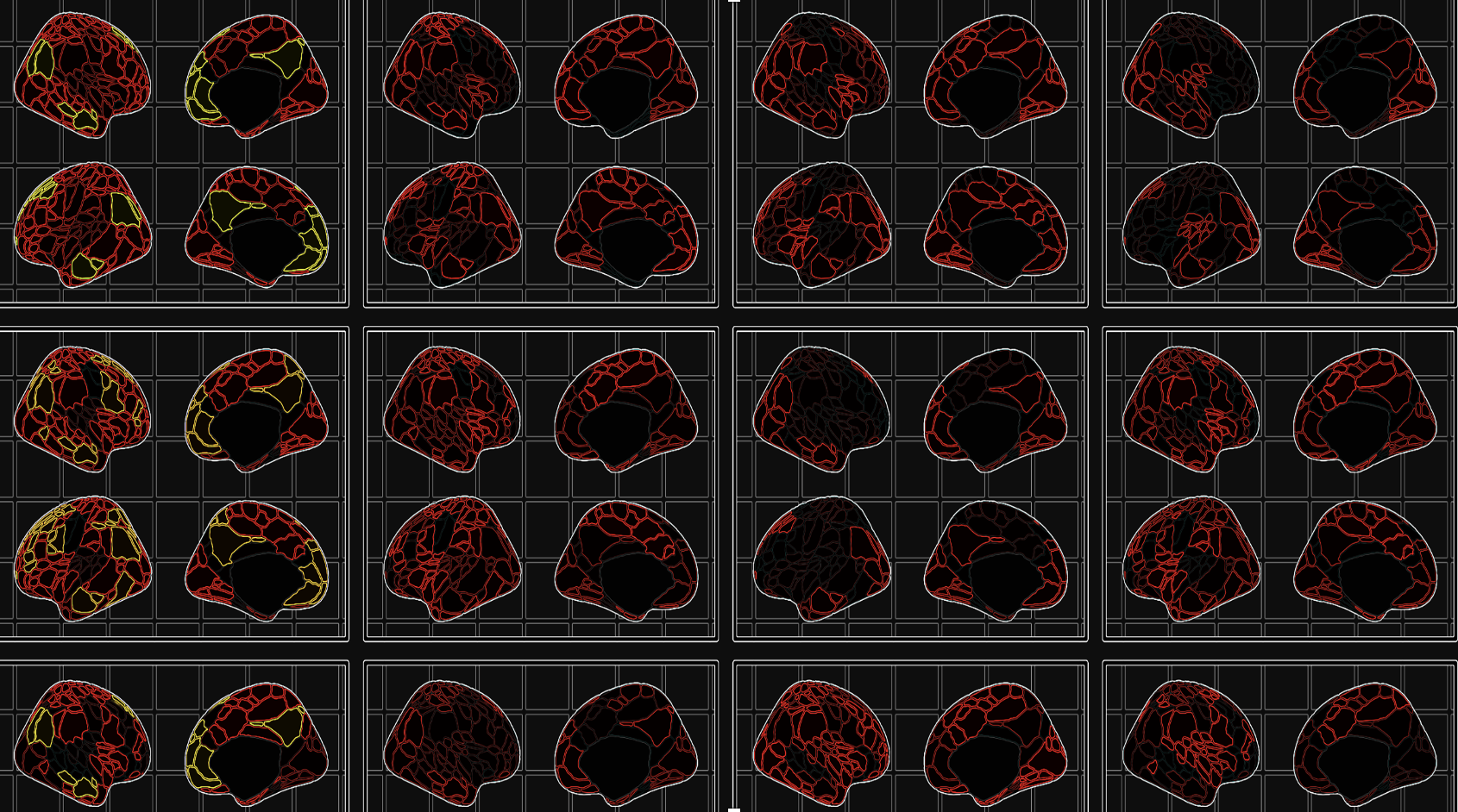Mapping the Neurodevelopmental Predictors of Psychopathology