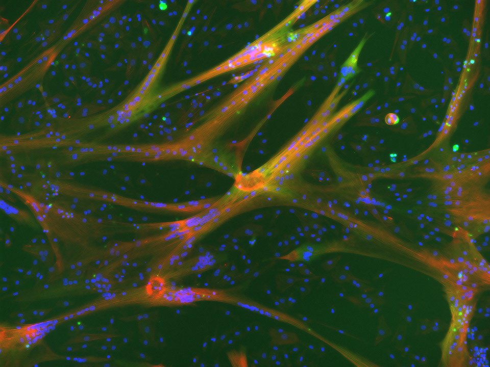 Animal-component-free media for cultured meat