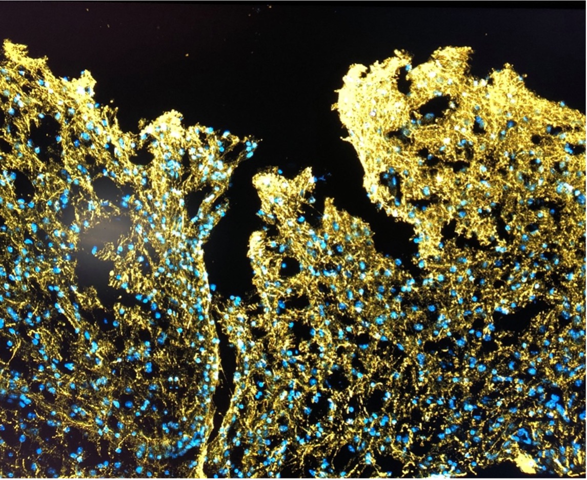 Repairing damaged brain: Wireless charging microgels may bring a new sight of brain function recovery