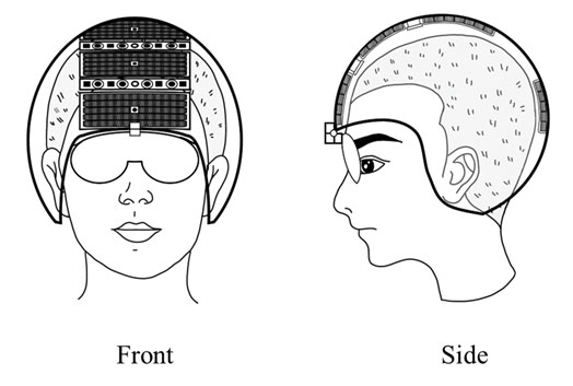 Preventing Post-Traumatic Stress Disorder (PTSD) in Rats with Pulsed 810 nm Laser Transcranial Phototherapy
