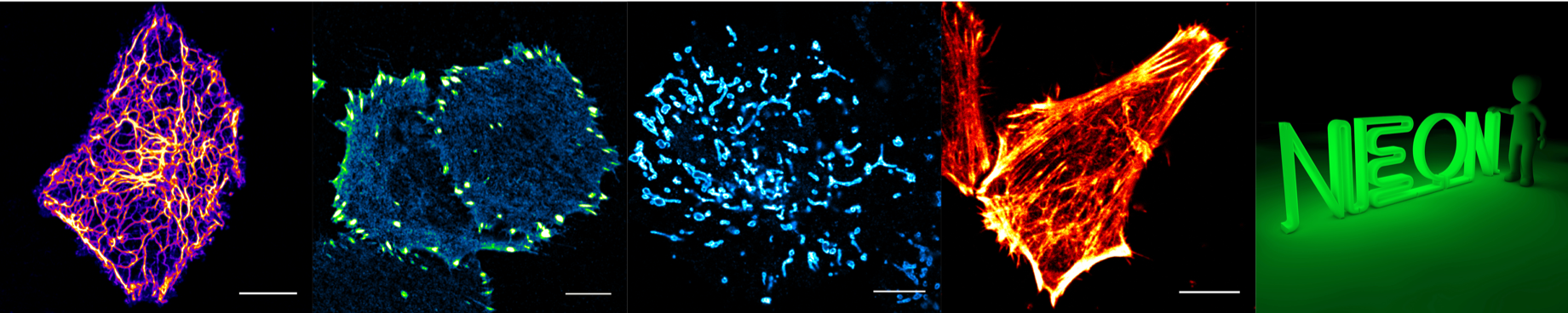 Choosing the “best” split fluorescent proteins for your applications