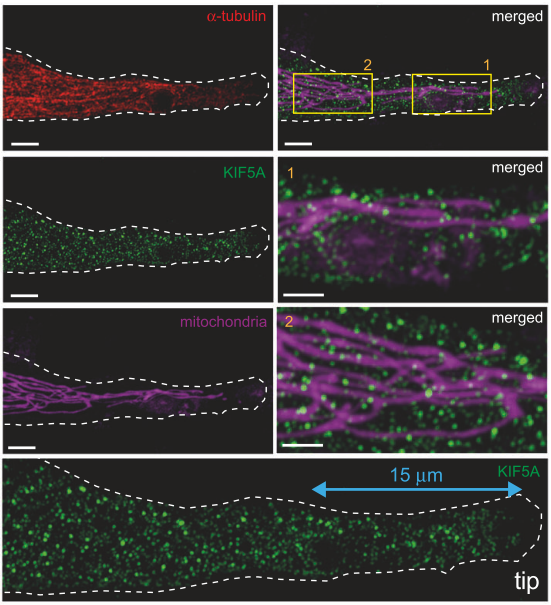 A human proteogenomic-cellular framework identifies KIF5A as a modulator of astrocyte process integrity with relevance to ALS