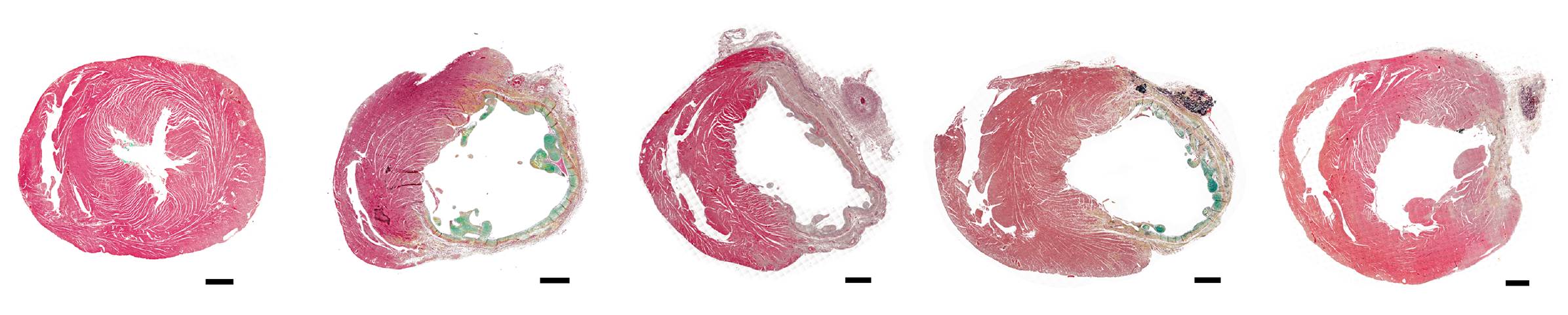Cell-free therapy for the recovery of the injured heart