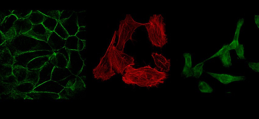 FEBS-ECM 2018:  Registration-Applications are now open