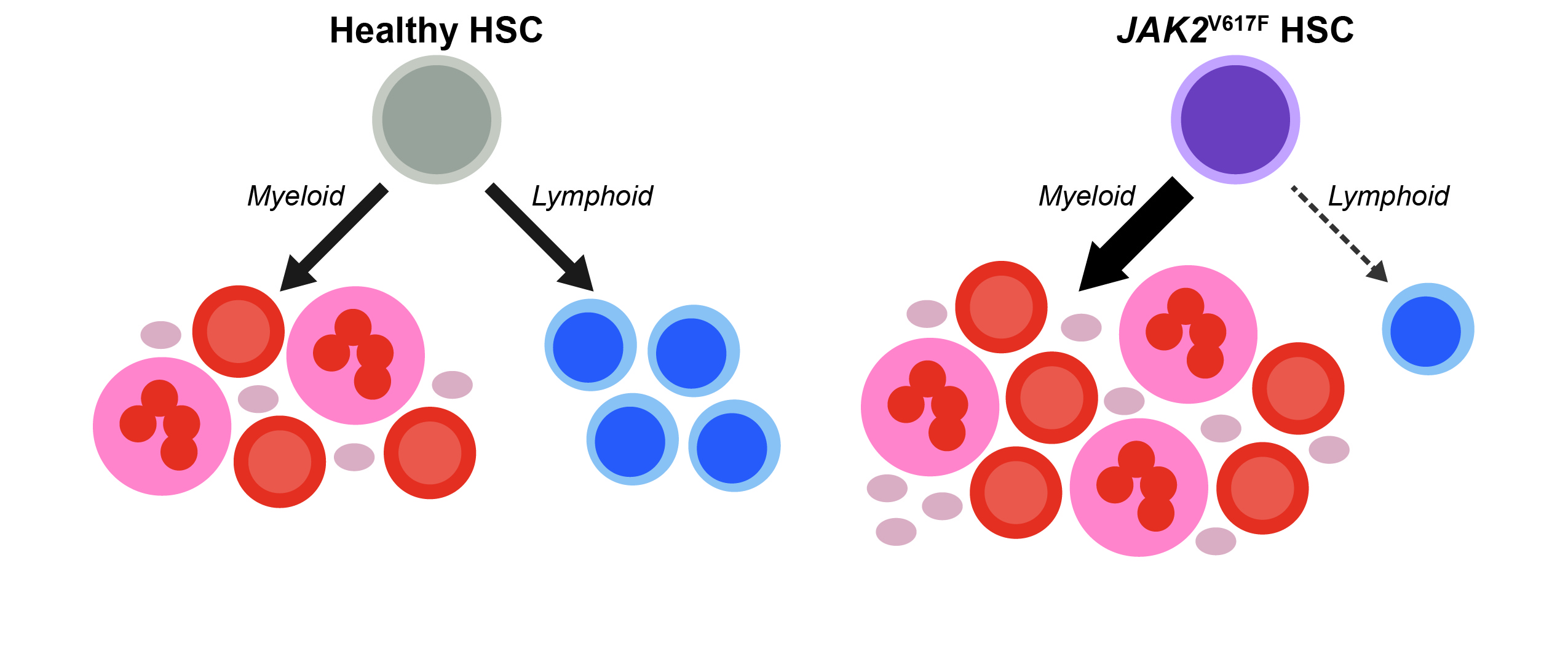 The Insidious Lymphodepletive Effect of Myeloproliferative Neoplasms