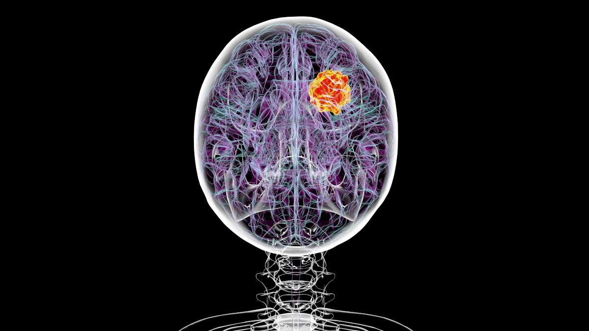 Call for papers: Cancer Neuroscience: from mechanisms to therapy