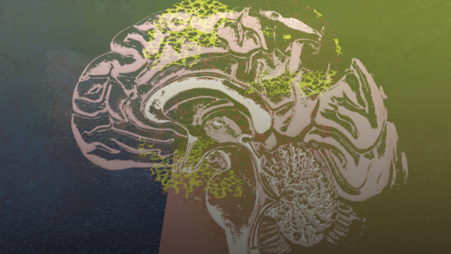 Electricity and the brain