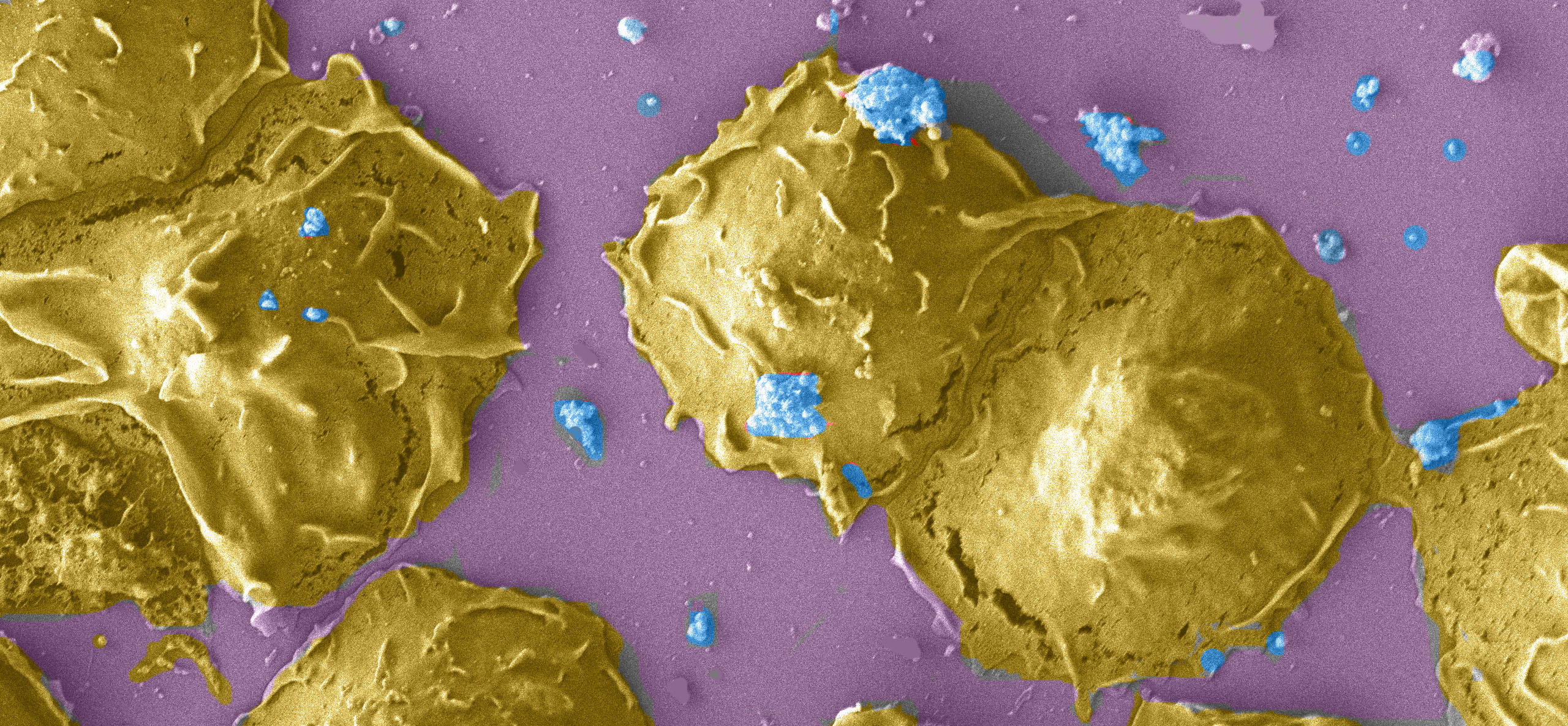 How Chlamydia tames the killer: mode of host-immune evasion revealed