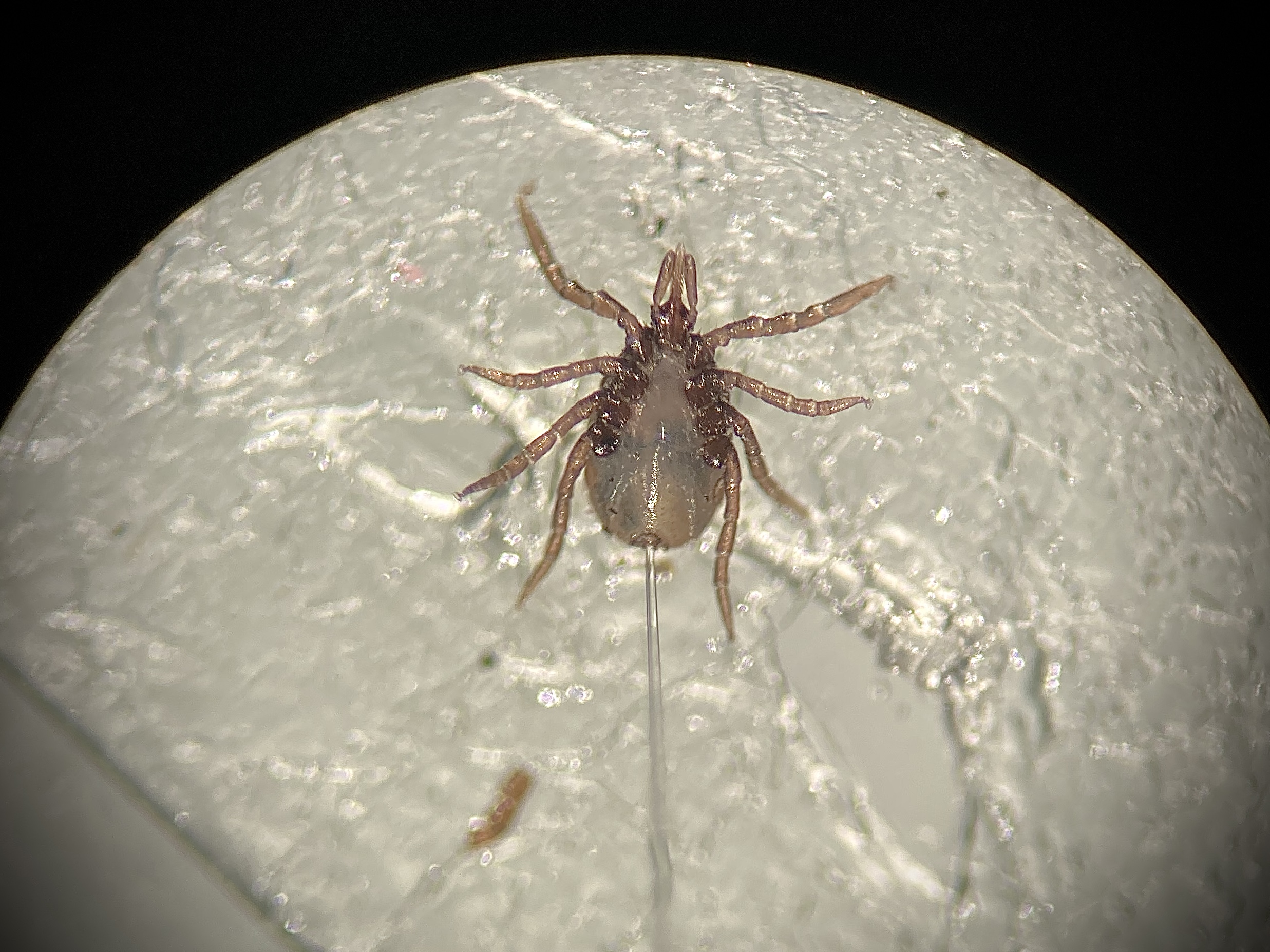 The Hidden Faces of Tick Immune Cells: Navigating Fitness and Microbial Challenges