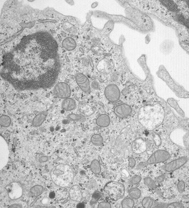 Energizing our immune cells: using different routes for the best response