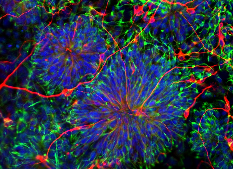 Translational opportunities in stem cell research