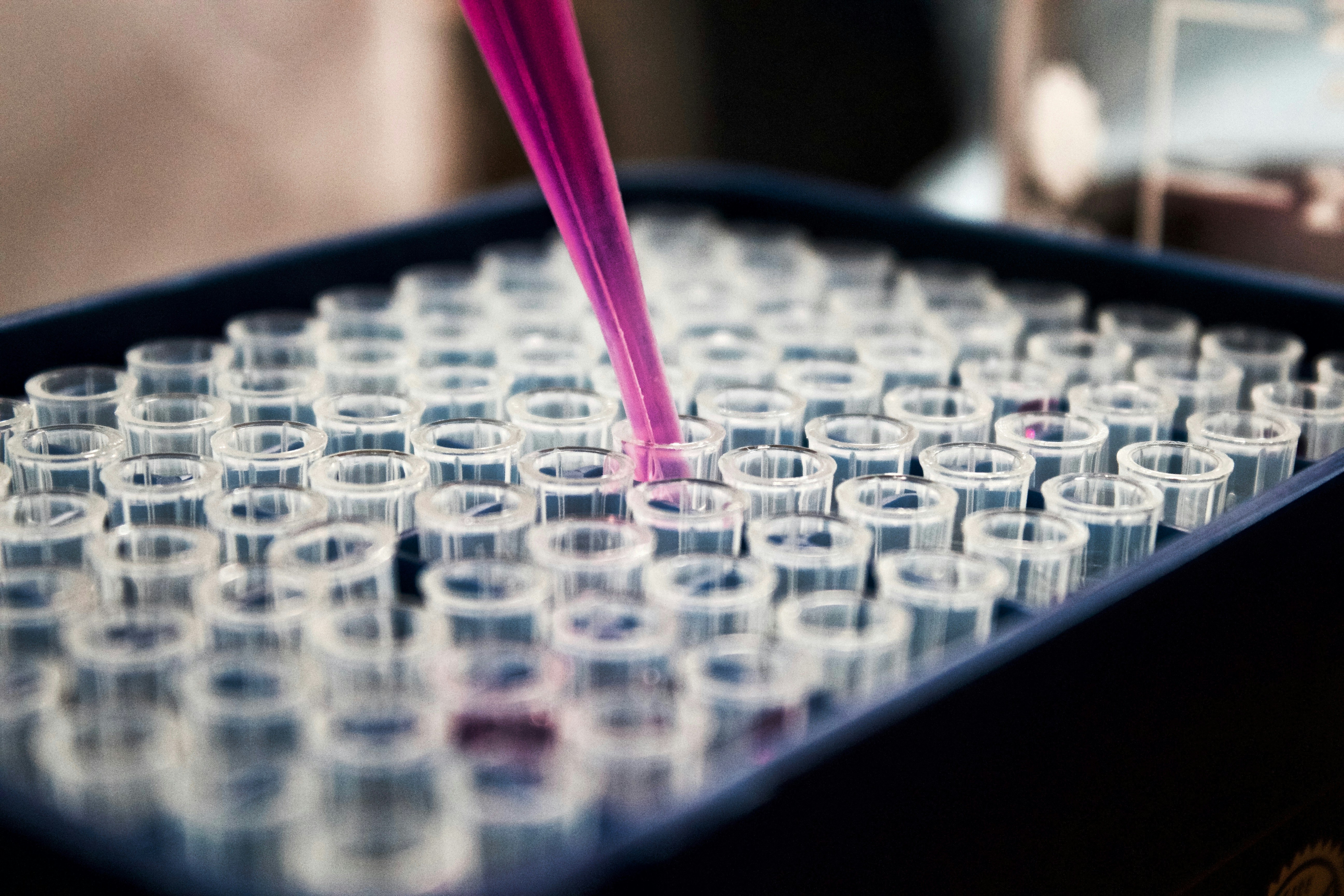 Unlocking the Complete Blood Count as a Risk Stratification Tool for Breast Cancer Using Machine Learning