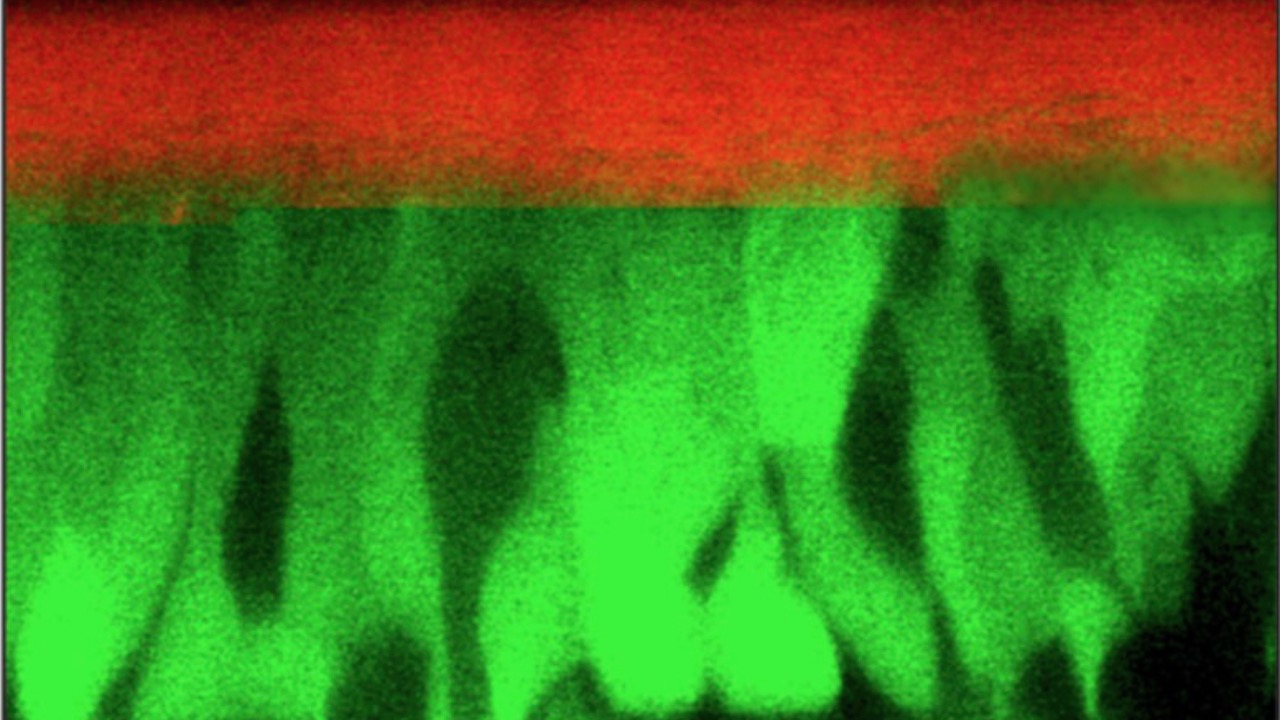Mucosa exposed to a warming atmosphere share risks faced by planetary vegetation  