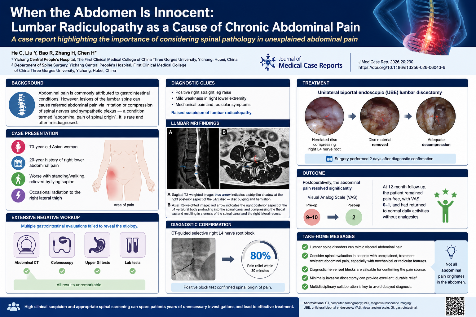 When the abdomen is innocent: recognizing lumbar radiculopathy as a cause of chronic abdominal pain
