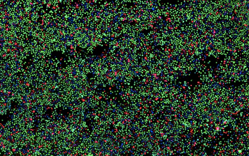 Targeting N-myristoyltransferases in cancer: when the end justifies the means