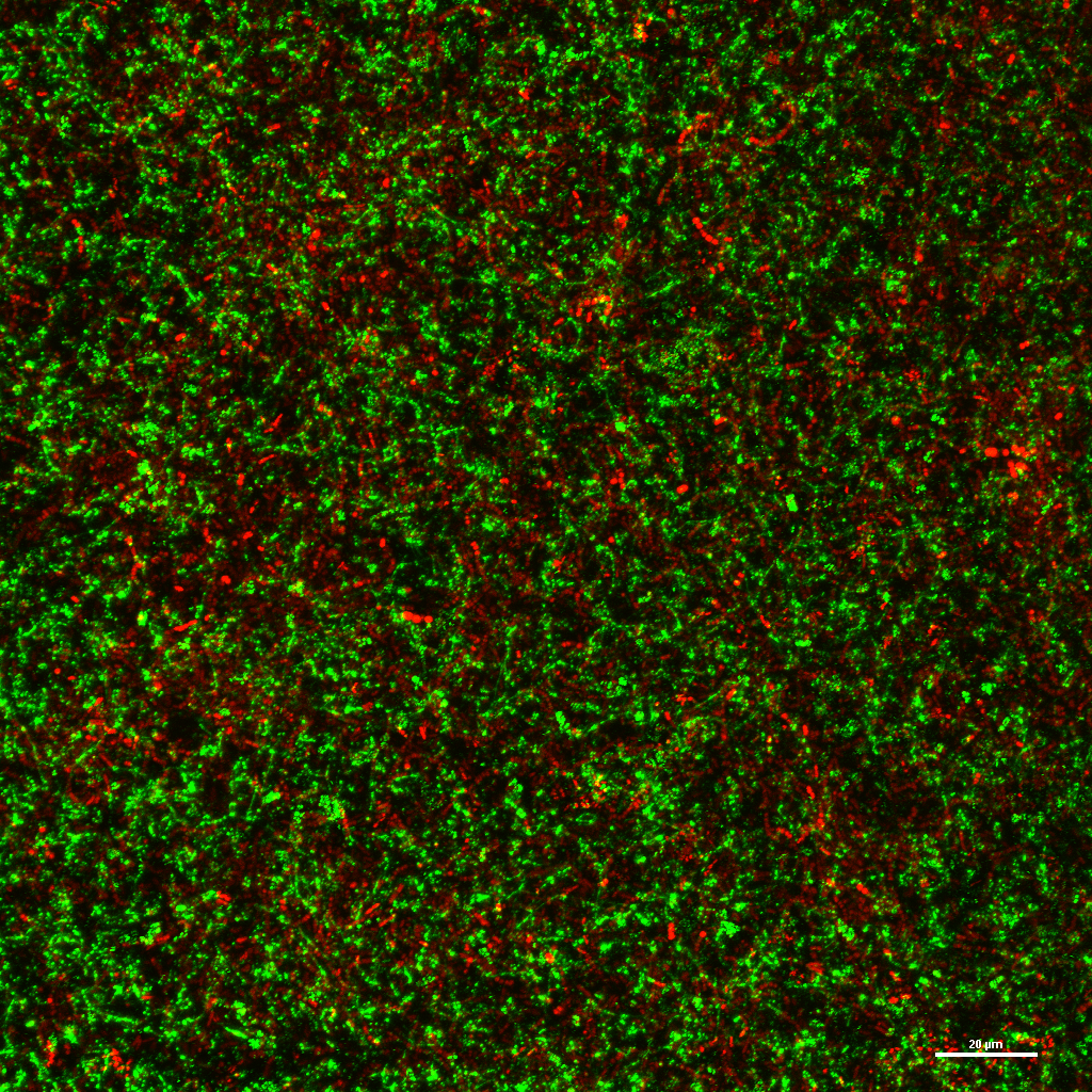 Friendly Hitchhiker: An oral commensal streptococcus exploits a Pseudomonas aeruginosa polysaccharide to promote its own colonization