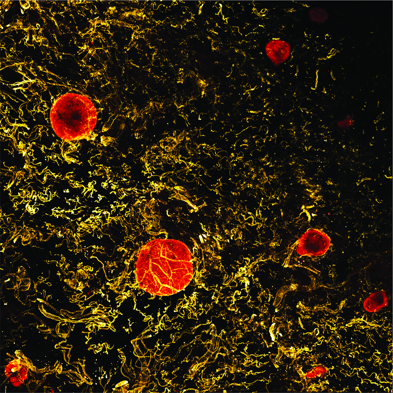 Peel to reveal: Dissecting out the intestinal immune system