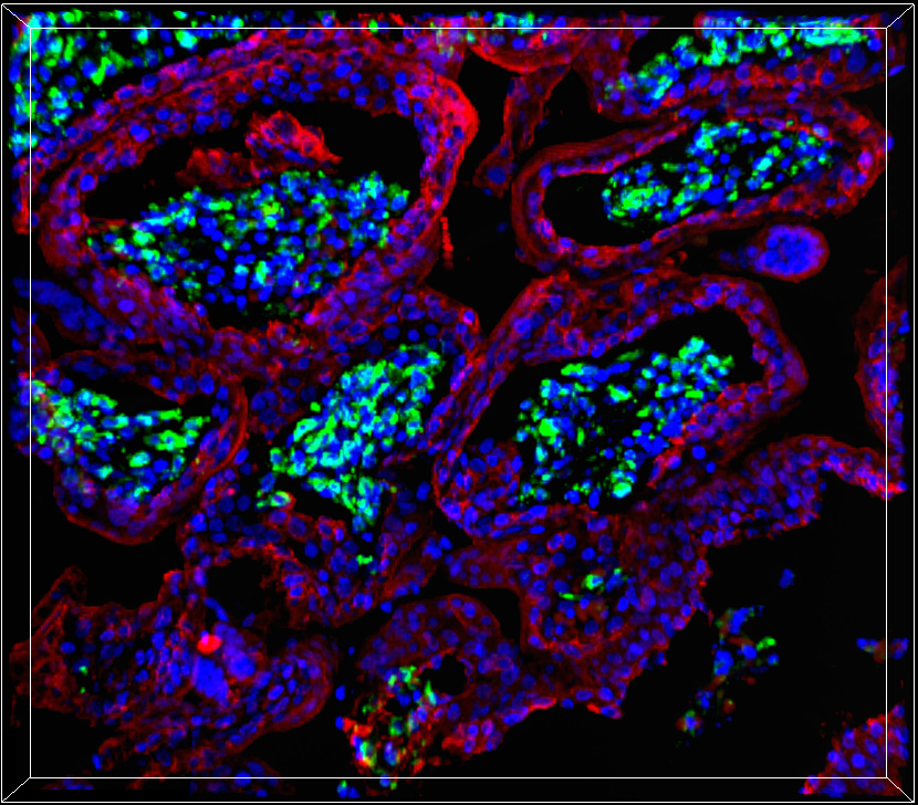 Hepatitis E virus: An underrated pathogen threatening human pregnancy 