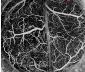 In vivo compression and imaging in the brain to measure the effects of solid stress