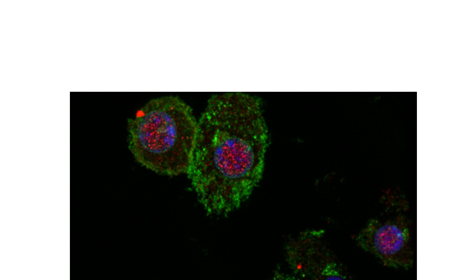 Investigating inflammasomes and cell death