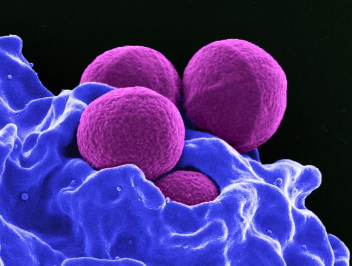Antibiotic resistance in bacteria from space
