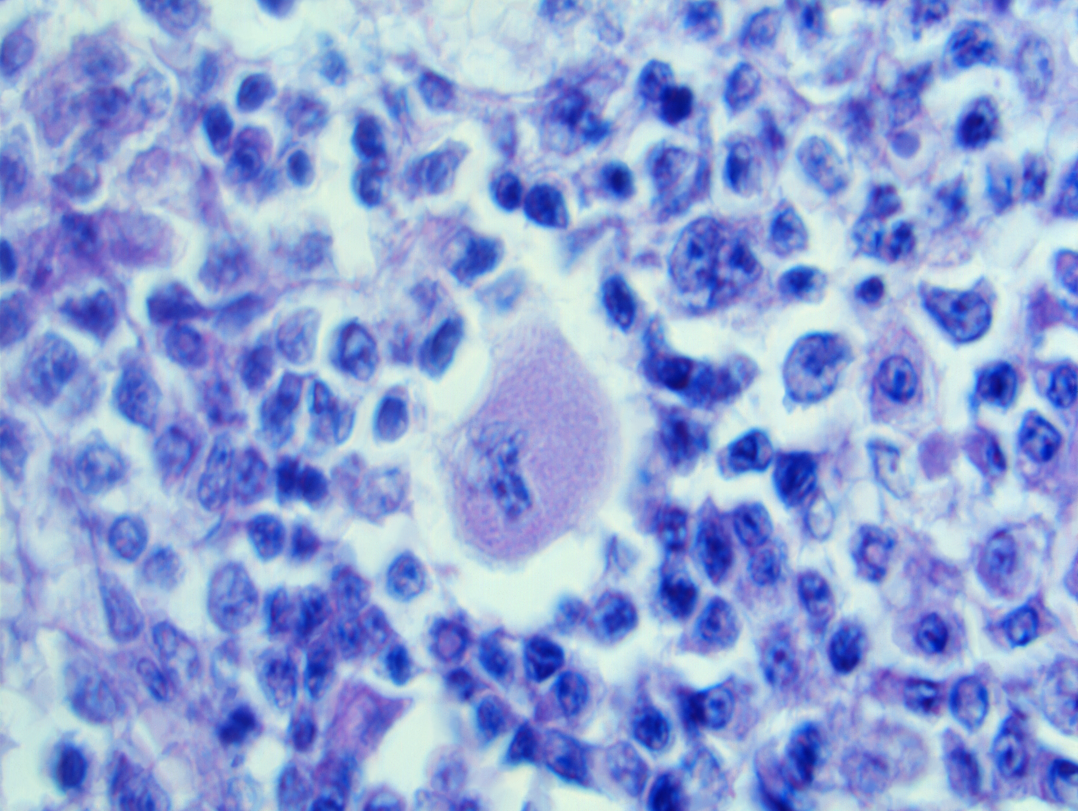 Two Steps Forward: Toxoplasmosis vaccine and the One Health paradigm