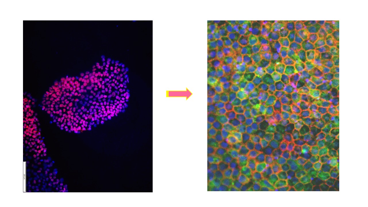 Human embryonic stem cells – from derivation to clinical regenerative applications 
