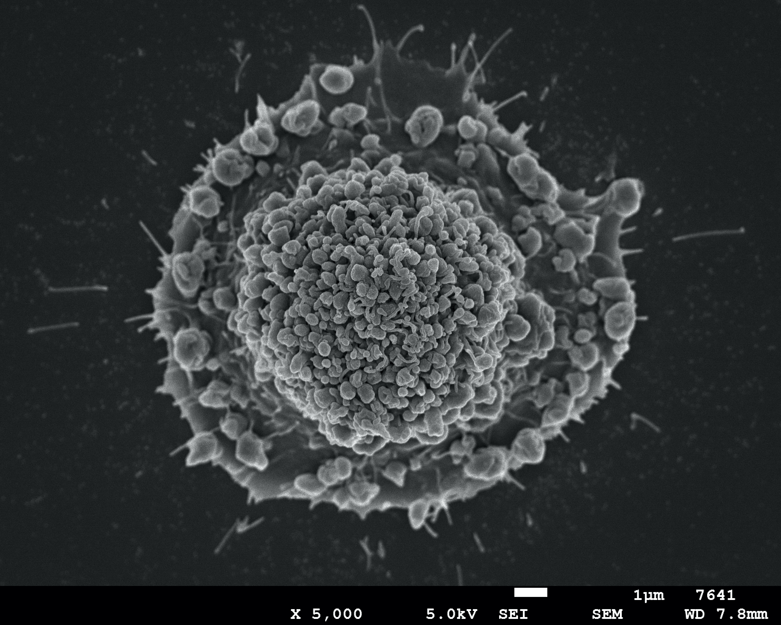 Platelets enhance malignant behaviours of gastric cancer cells via direct contacts